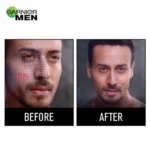 40022551_10-garnier-men-acno-fight-anti-pimple-face-wash.webp